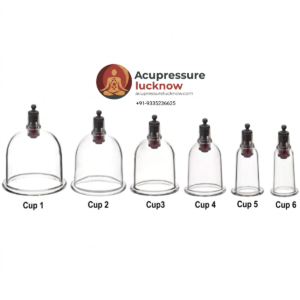 Hijama Cups